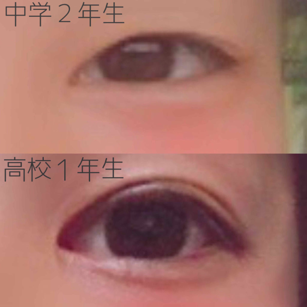 3CE FULL COVER CONCEALER/3CE/リキッドコンシーラーを使ったクチコミ（2枚目）