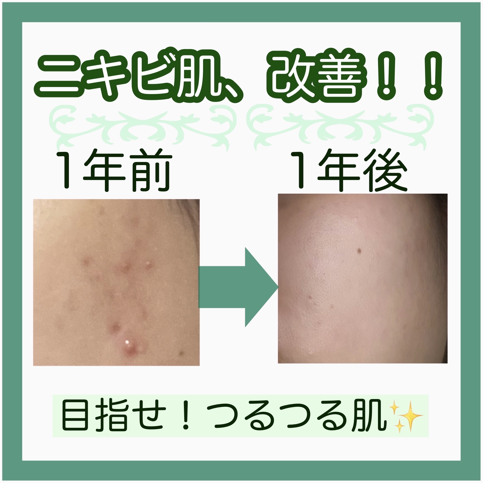 ザ・タイムR アクア/IPSA/化粧水を使ったクチコミ（1枚目）