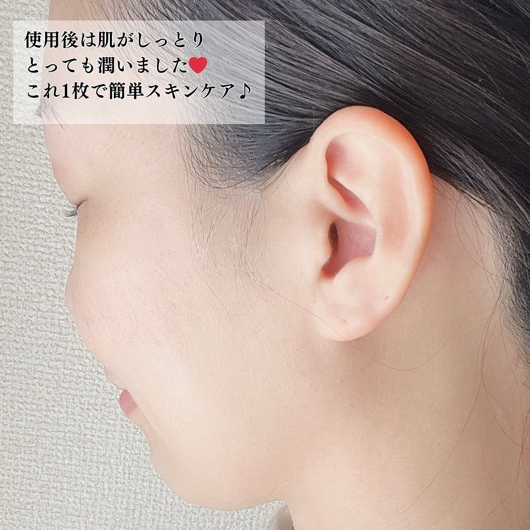 恵み肌 乳液タイプフェイスマスクS/ユノス/シートマスク・パックを使ったクチコミ(6枚目)