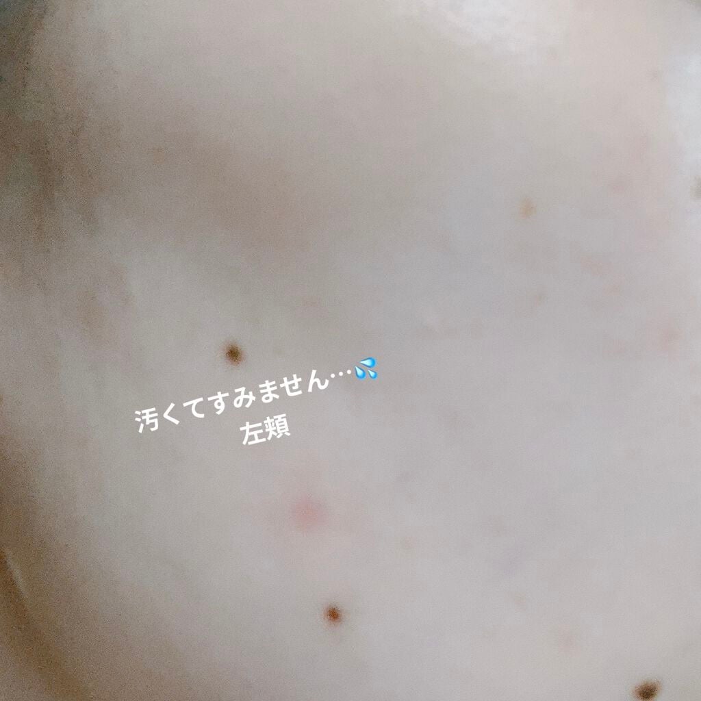 スードバンブートナー/KEEP COOL/化粧水を使ったクチコミ(4枚目)