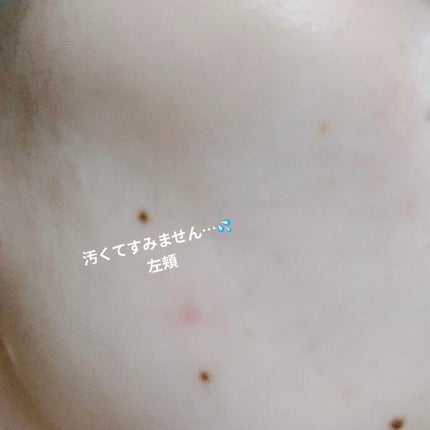 スードバンブートナー/KEEP COOL/化粧水を使ったクチコミ(4枚目)