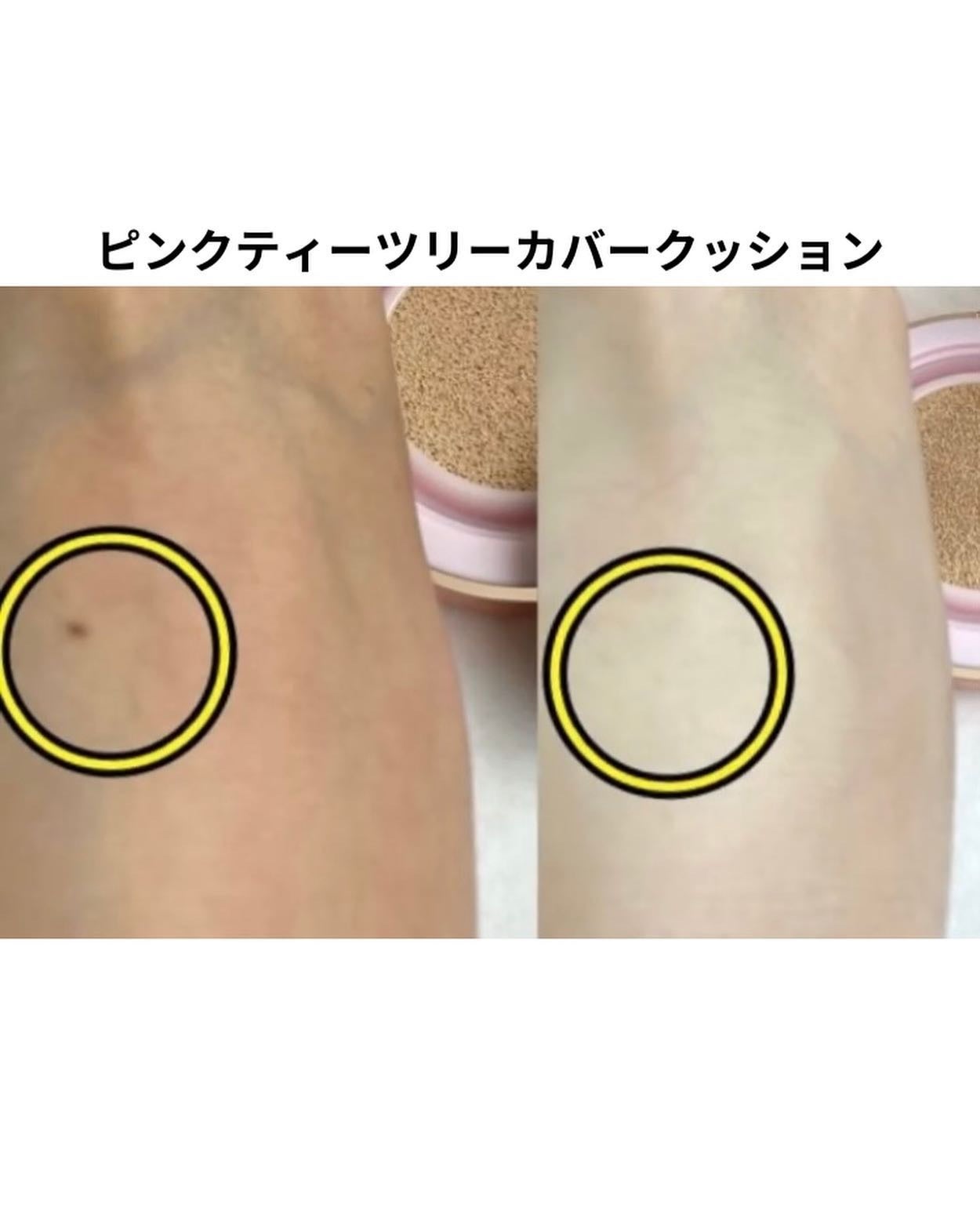 ピンクティーツリーカバークッション/APLIN/クッションファンデーションを使ったクチコミ(2枚目)