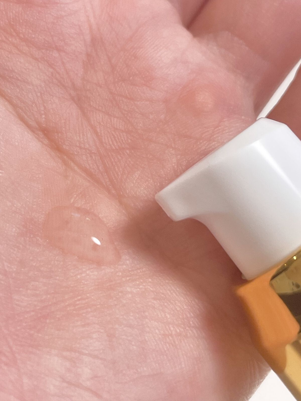 ミライナルX5/A style/頭皮ローションを使ったクチコミ（2枚目）