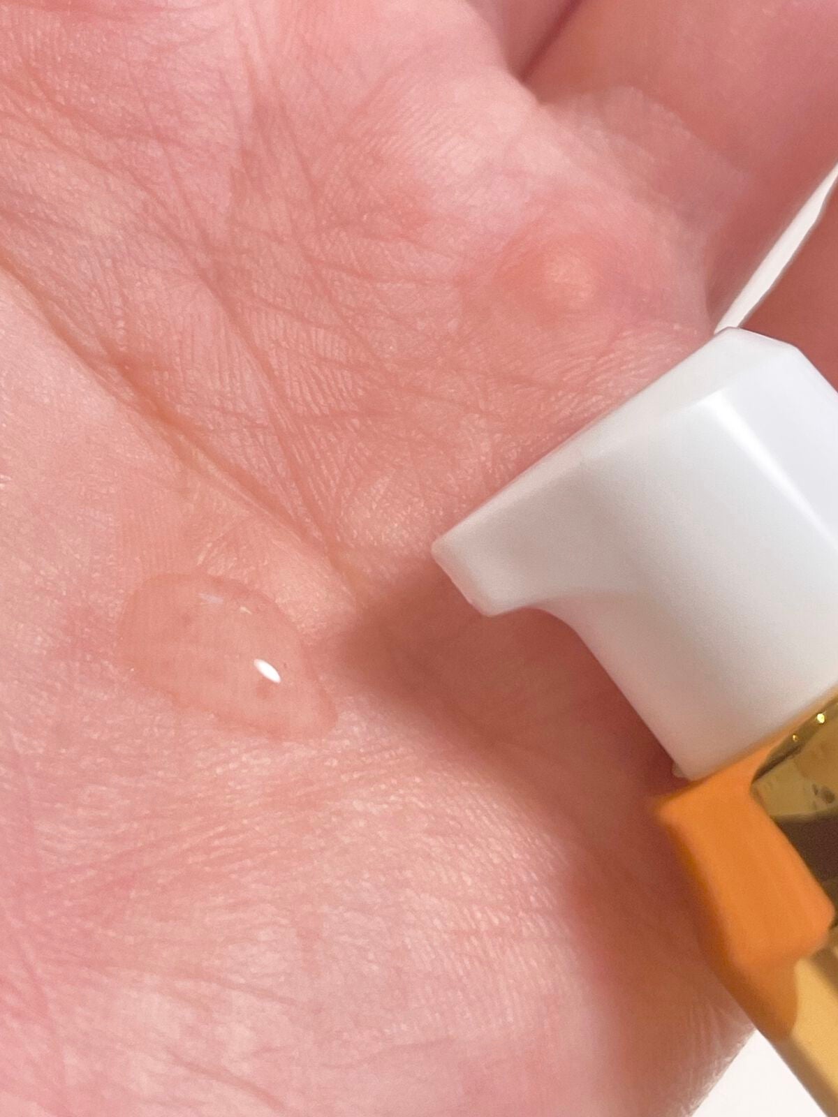 ミライナルX5/A style/頭皮ローションを使ったクチコミ(2枚目)