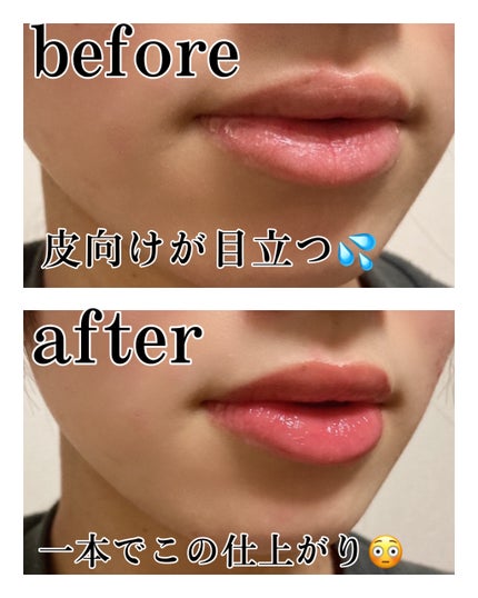 ãªãŒãã€ã°ãã¹ ãªãããªã€ã«/ãªã³ã¡ã« ãã³ãã³/ãªããã°ãã¹ã䜿ã£ãã¯ãã³ãïŒ4æç®ïŒ