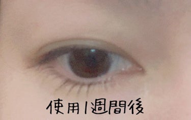 FEG  Eyelash  Enhancer/FEG/まつげ美容液を使ったクチコミ（3枚目）