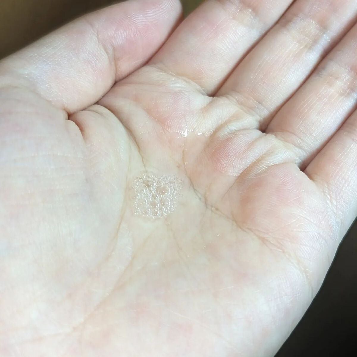 カルテHD バランスケア ローション/カルテHD/化粧水を使ったクチコミ(2枚目)