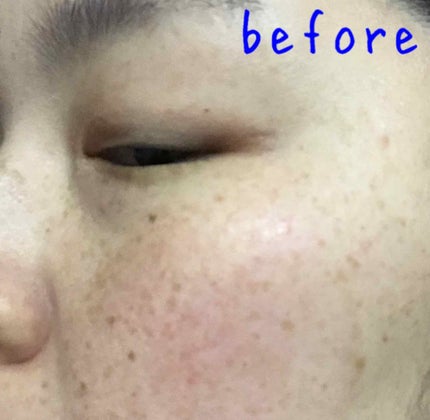 ローション I/BENEFIQUE/化粧水を使ったクチコミ(2枚目)