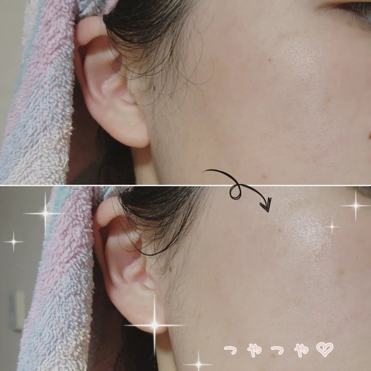 たまご保湿ジェル/ココエッグ/美容液を使ったクチコミ（3枚目）