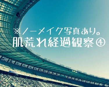 週末はだいたいJリーグ観て美味しいもの食べる生活です。(1枚目は味スタ)

間が空きましたが経過観察。
先日載せたビタCセラム使ってるおかげか肌ツヤはよくなってきました。オパールR-Ⅲもニキビ以外にはし