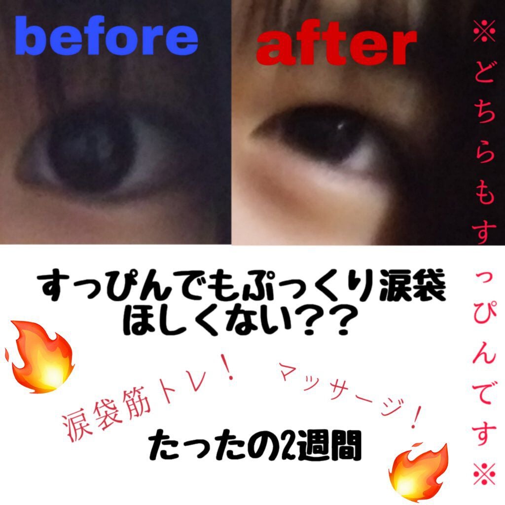 オリジナル ピュアスキンジェリー/ヴァセリン/ボディクリームを使ったクチコミ(1枚目)