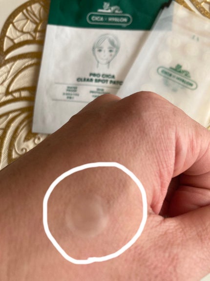 プロCICA クリアスポットパッチ/VT/その他スキンケアを使ったクチコミ(2枚目)