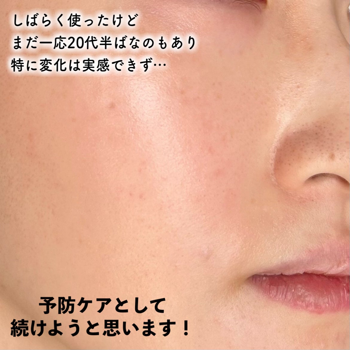 ピーディーアールエヌエッセンス PDRN 100/VT/美容液を使ったクチコミ(6枚目)