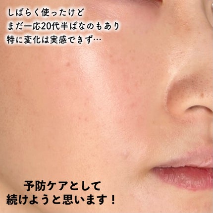 ピーディーアールエヌエッセンス PDRN 100/VT/美容液を使ったクチコミ(6枚目)