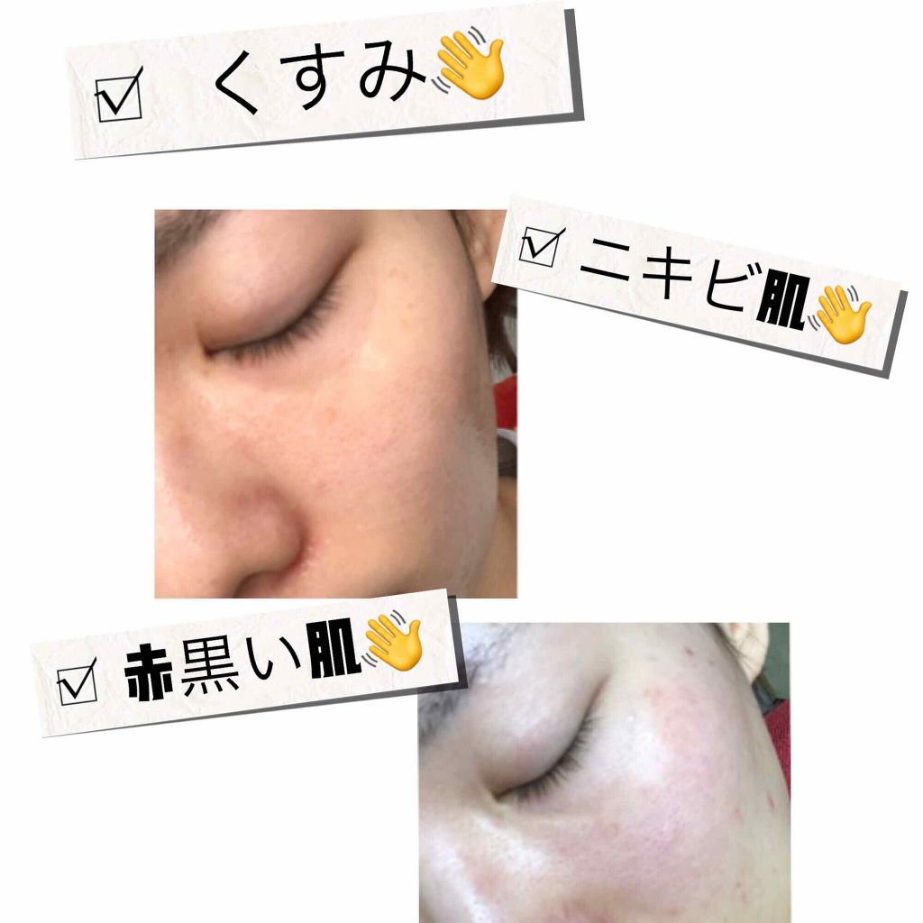 ロゼット 洗顔パスタ ガスールブライト/ロゼット/洗顔フォームを使ったクチコミ（1枚目）