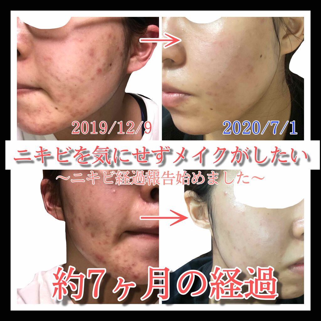 明色美顔水 薬用化粧水/美顔/化粧水を使ったクチコミ（1枚目）