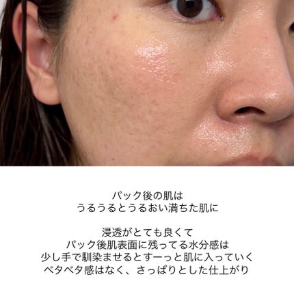 PHセンシティブマスク ポアフィット/SAM'U/シートマスク・パックを使ったクチコミ(8枚目)