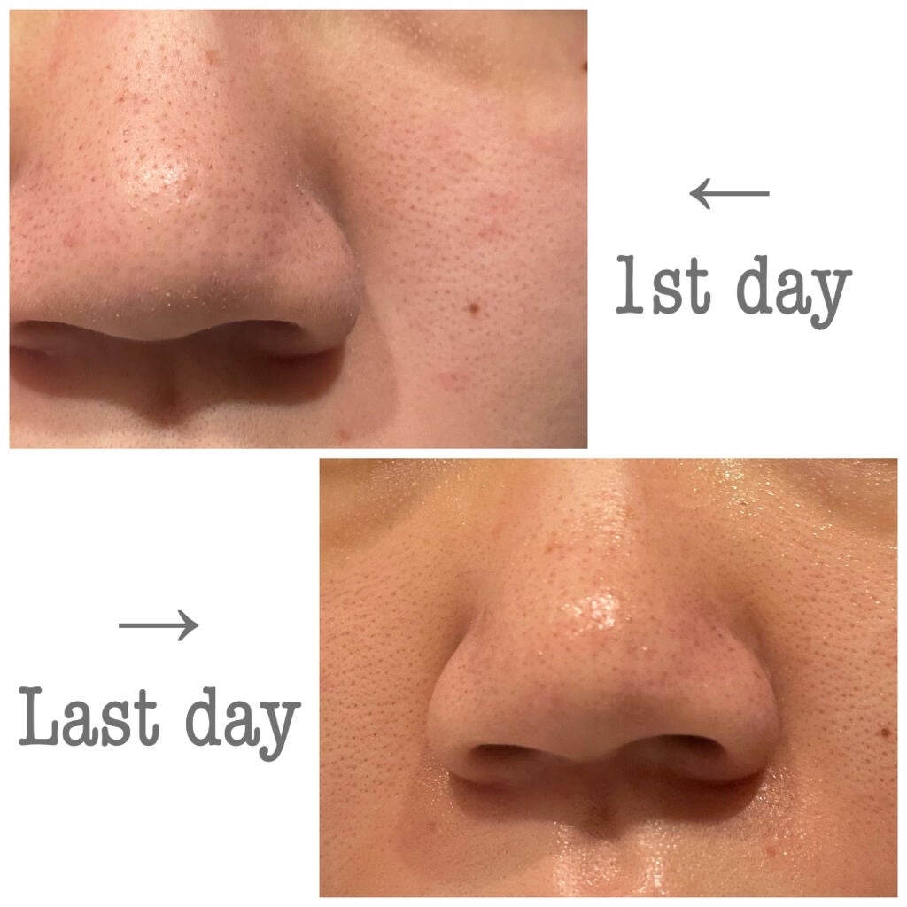 コロカリア スーパーオールインワンジェル(旧)/ナナローブ/オールインワン化粧品を使ったクチコミ(2枚目)