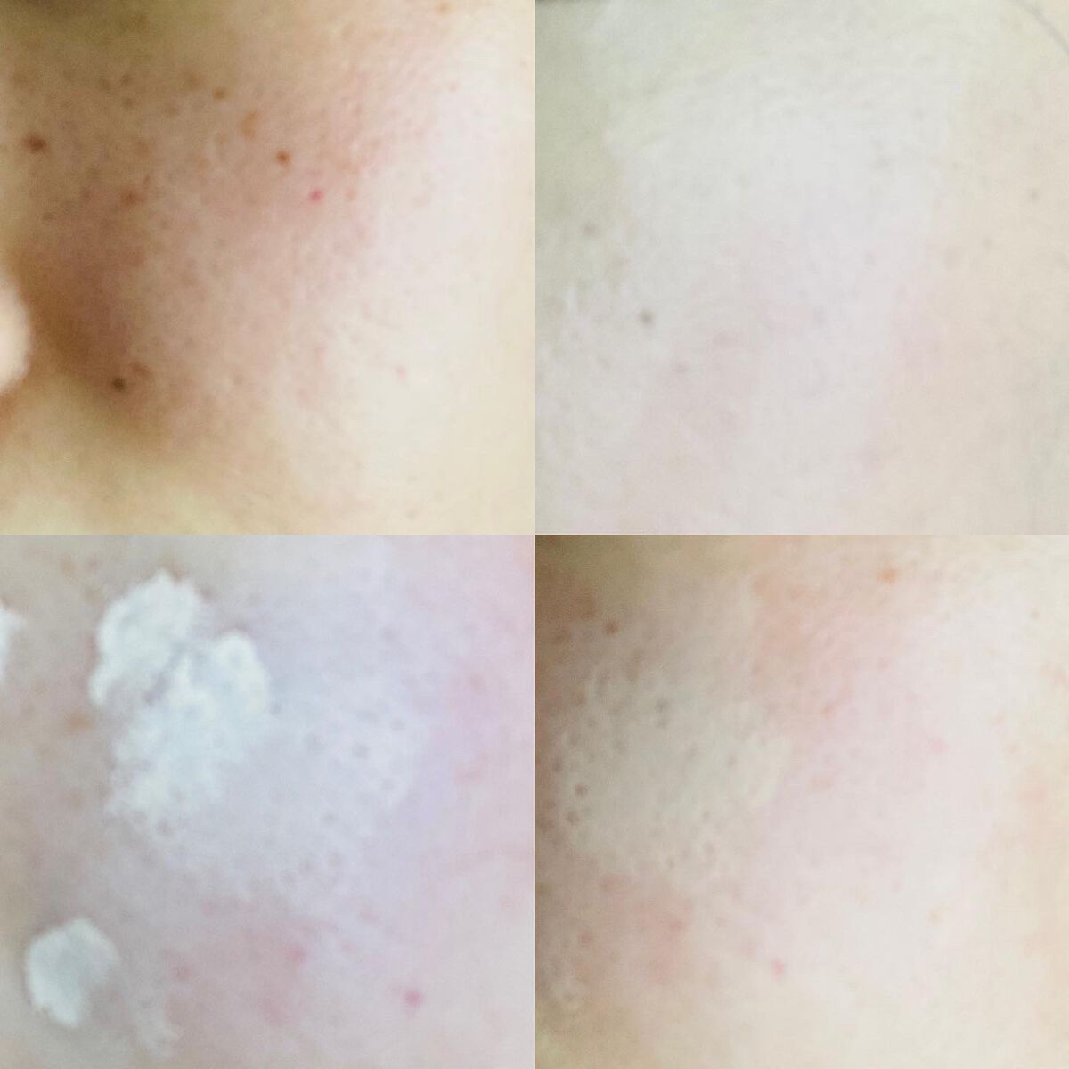 タトゥーウォータープルーフスカーコンシーラー/フォレンコス/リキッドコンシーラーを使ったクチコミ（3枚目）