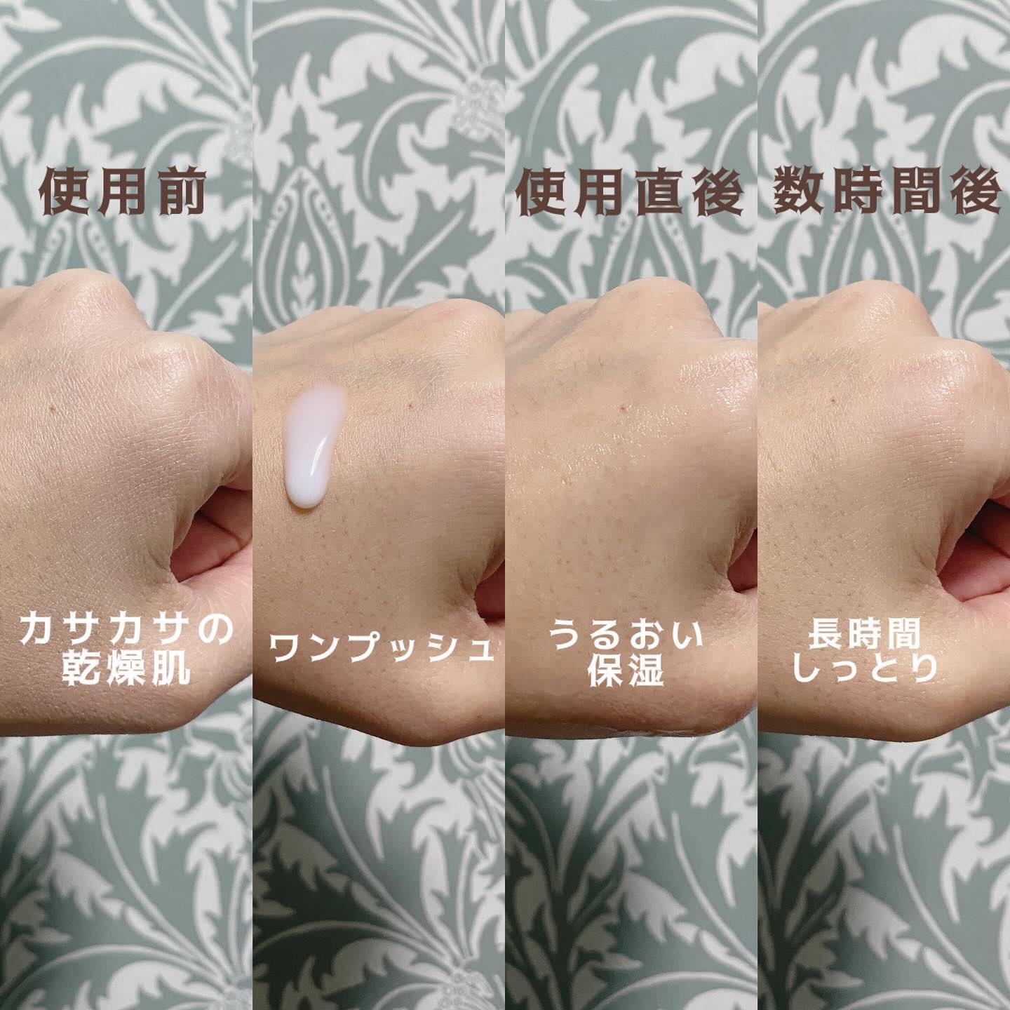 サミュ PHセンシティブフェイシャルトリートメント/SAM'U/美容液を使ったクチコミ（2枚目）