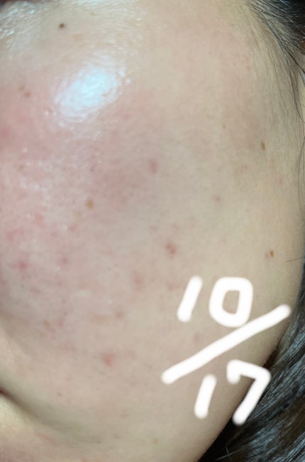 パケ買いはしないよ on LIPS 「【使った商品】セレクトオーガニックスパ 化粧水✼••┈┈••✼..」(3枚目)