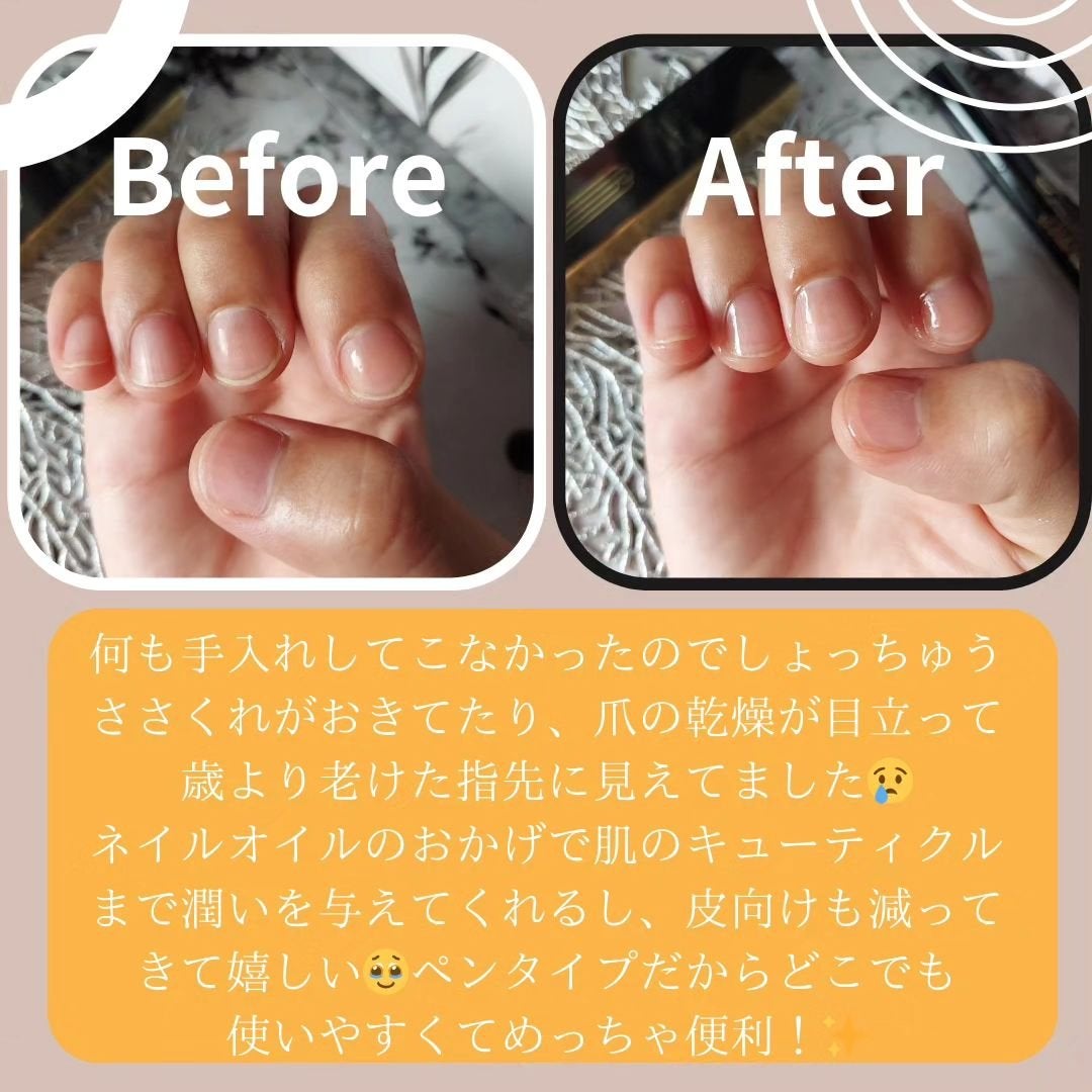 ブルーブライトネイルオイル/EMROSÉ/ネイルオイル・トリートメントを使ったクチコミ(3枚目)