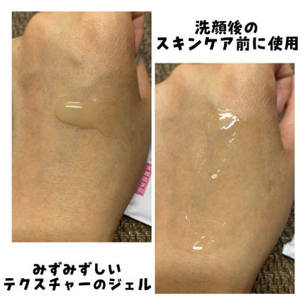 ニキビあとケアジェル/アットノン/その他スキンケアを使ったクチコミ(5枚目)