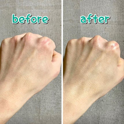 ピュアフィットシカセラム/COSRX/美容液を使ったクチコミ(5枚目)