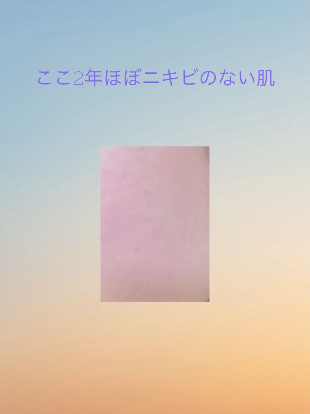 ブライトニングケア ローション M（医薬部外品）/アクアレーベル/化粧水を使ったクチコミ（1枚目）