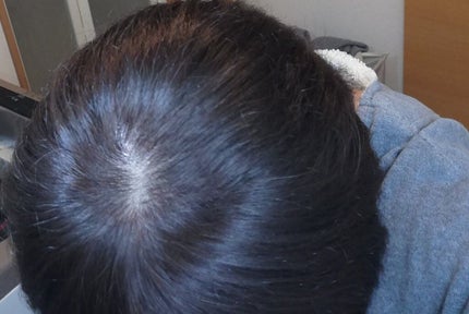 カラージェニック ミルキーヘアカラー (ちらっと白髪用)/サイオス/ヘアカラーを使ったクチコミ(5枚目)