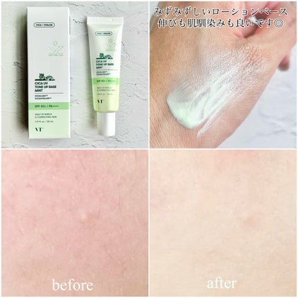 リードルショット100/VT/美容液を使ったクチコミ(5枚目)