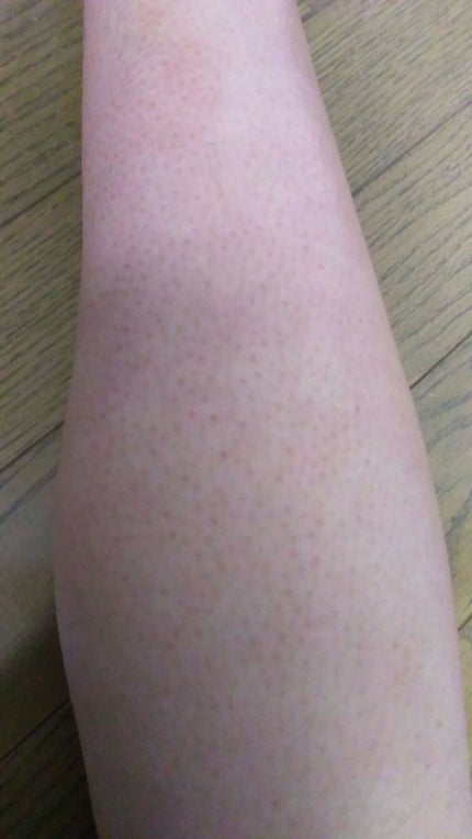 ハトムギ化粧水(ナチュリエ スキンコンディショナー R )/ナチュリエ/化粧水を使ったクチコミ(2枚目)