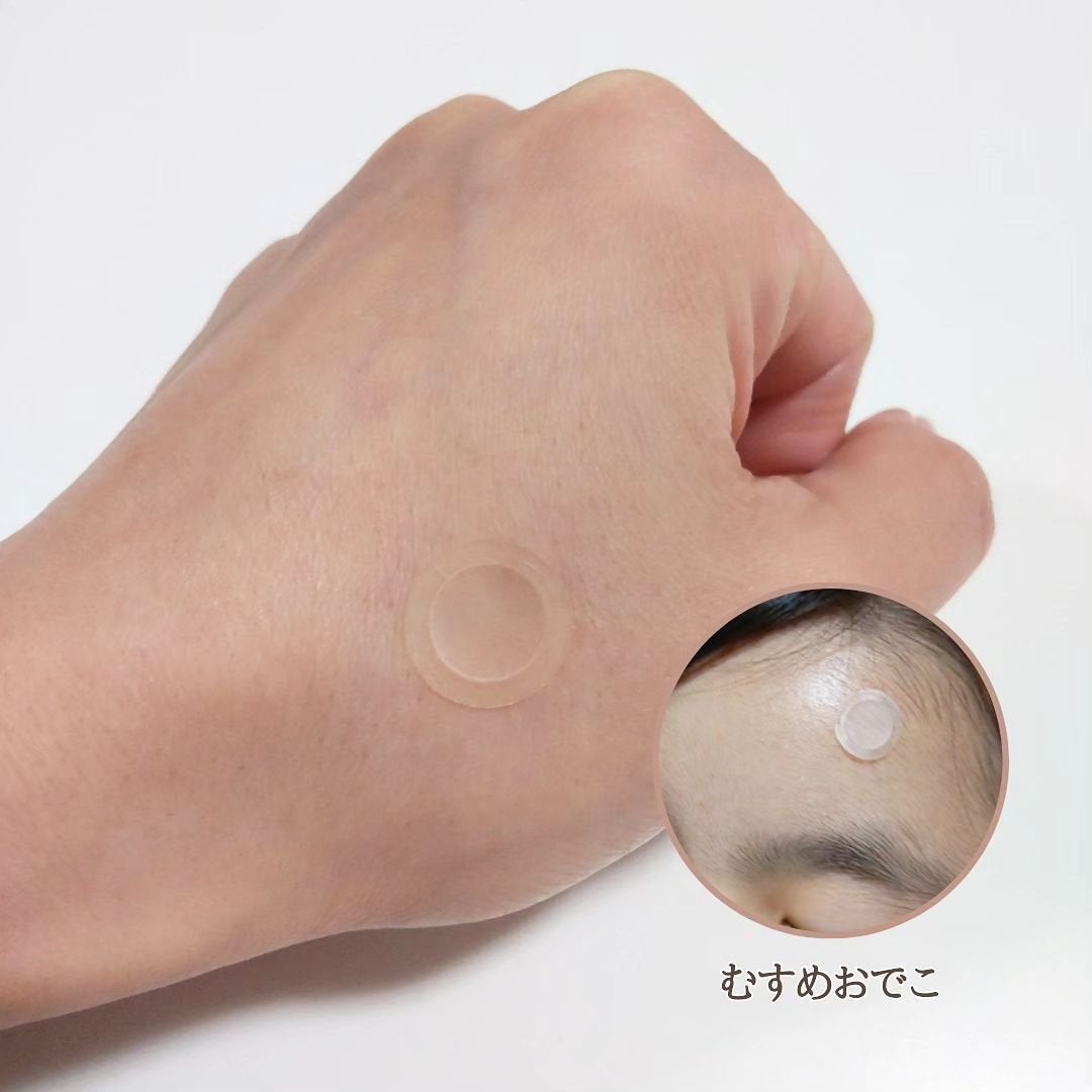 エーキュアショットスポットパッチ/obsero/にきびパッチを使ったクチコミ(6枚目)