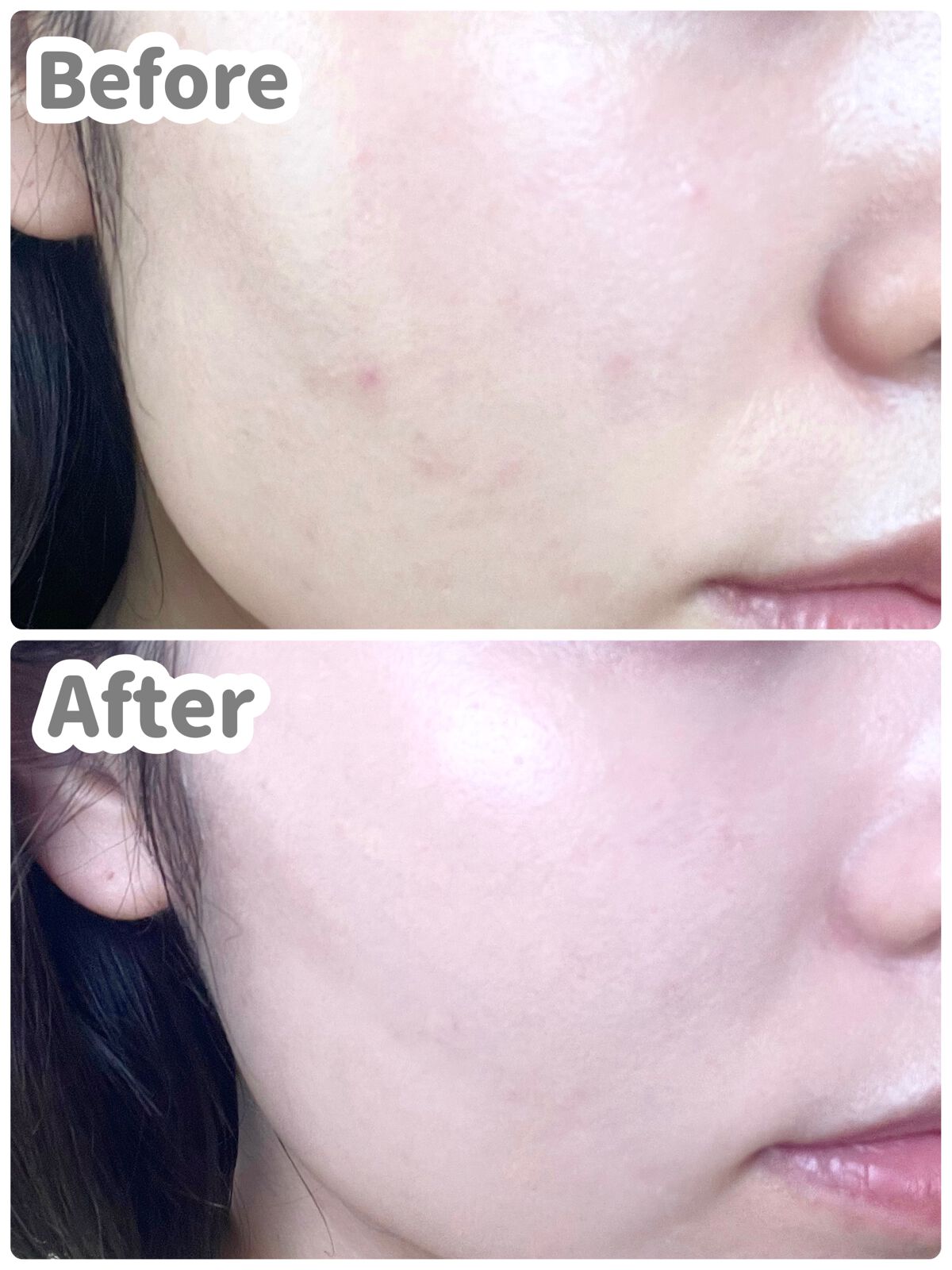 【旧】ディオールスキン フォーエヴァー スキン コレクト コンシーラー/Dior/リキッドコンシーラーを使ったクチコミ(4枚目)