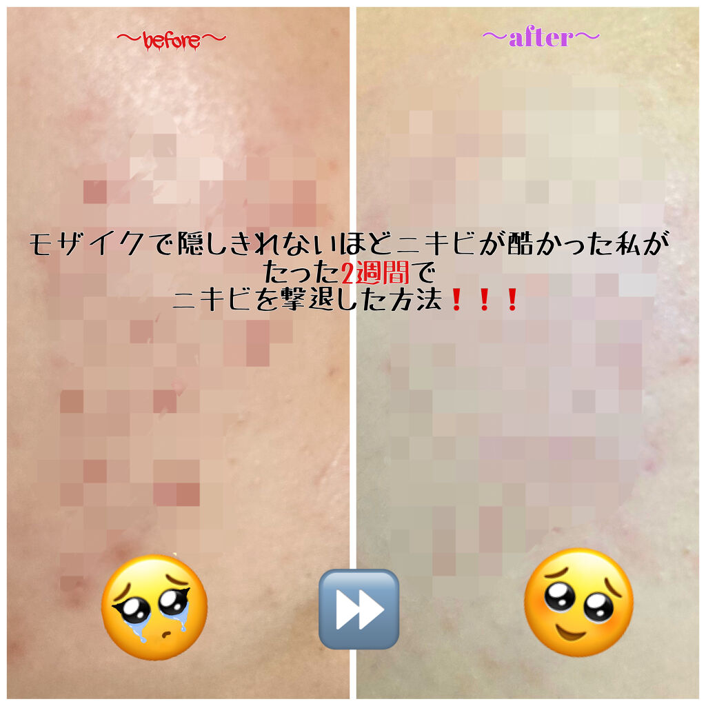 CICA ケアクリーム/BEAUSTA/フェイスクリームを使ったクチコミ（1枚目）