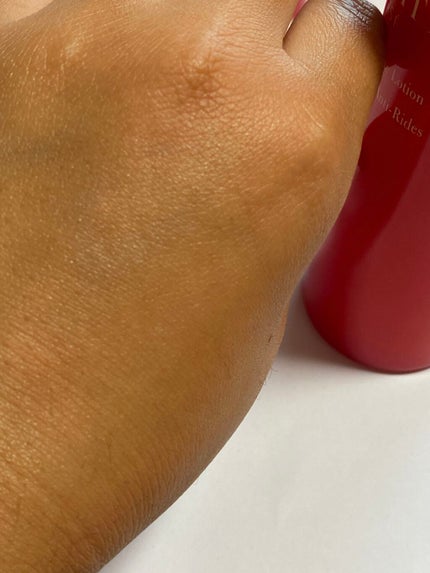 愛悠(ゆゆちゃ) on LIPS 「インフィニティインテンシブリンクルローション肌の柔軟性を高め、..」(4枚目)