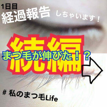 【私のまつ毛Life (まつ育)】

今回は #私のまつ毛Life 第二弾！！

↓↓↓前回の経過報告をしたいと思います！↓↓↓

https://lipscosme.com/posts/1993736