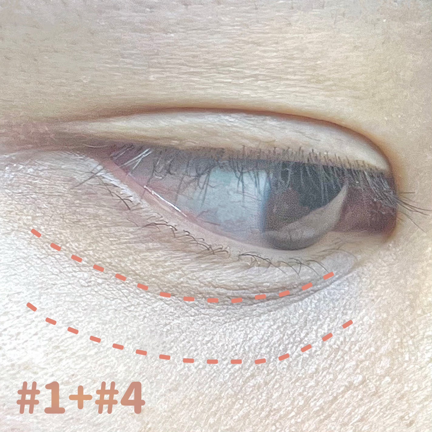 ダブルラスティング コンシーラーパレット/ETUDE/パレットコンシーラーを使ったクチコミ(6枚目)