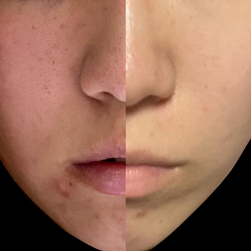 お米のマスク/毛穴撫子/シートマスク・パックを使ったクチコミ(2枚目)