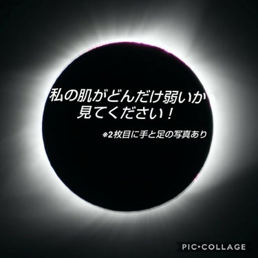 ⚠2枚目に汚い手と足の写真あります


いきなりですが相談です、、、、
写真二枚目に乗っているように、私の肌は弱いです、、、、



毎年このようになります。今年は特に足のあせもが酷いです、、、、

こ