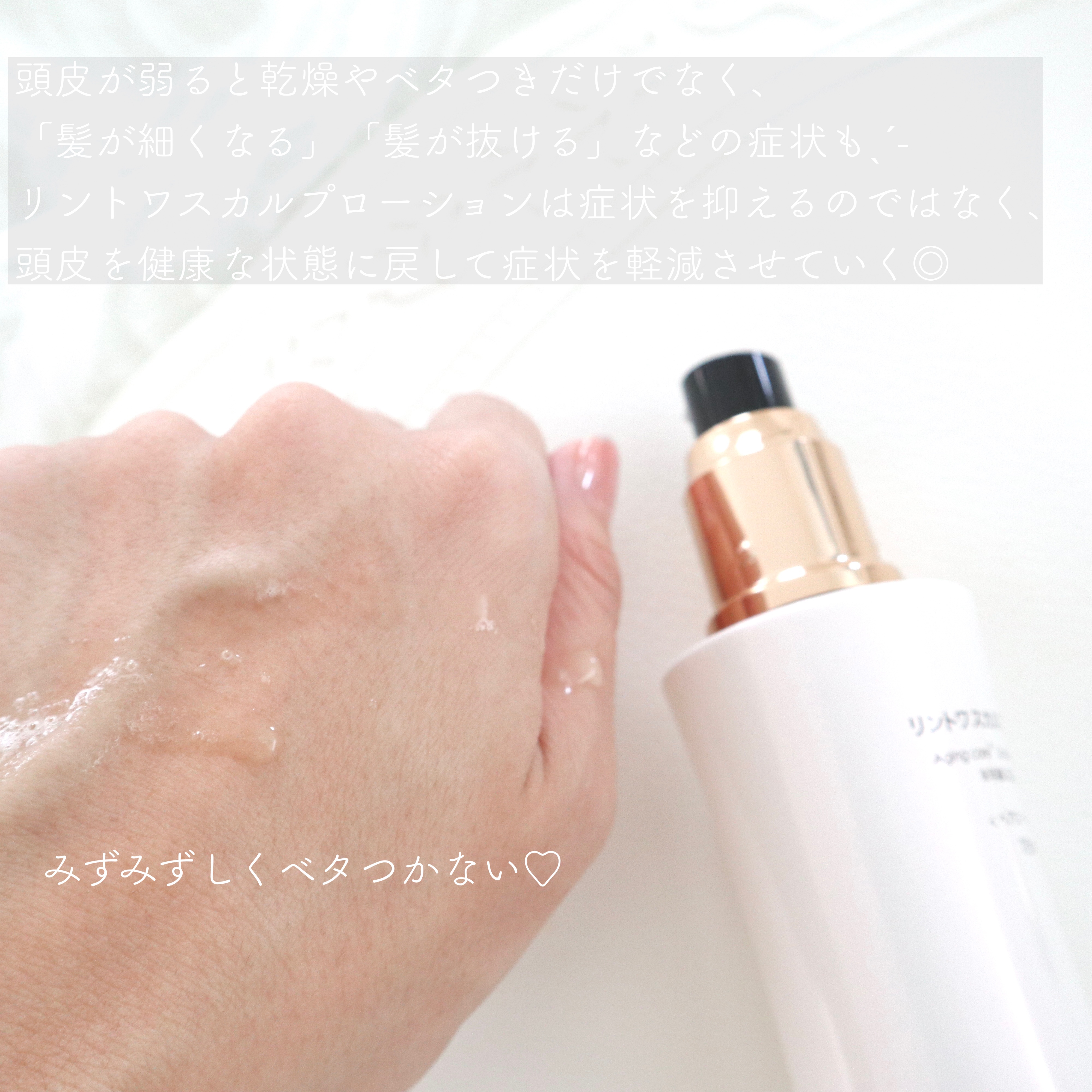 スカルプローション/Rintor/頭皮ローションを使ったクチコミ（2枚目）