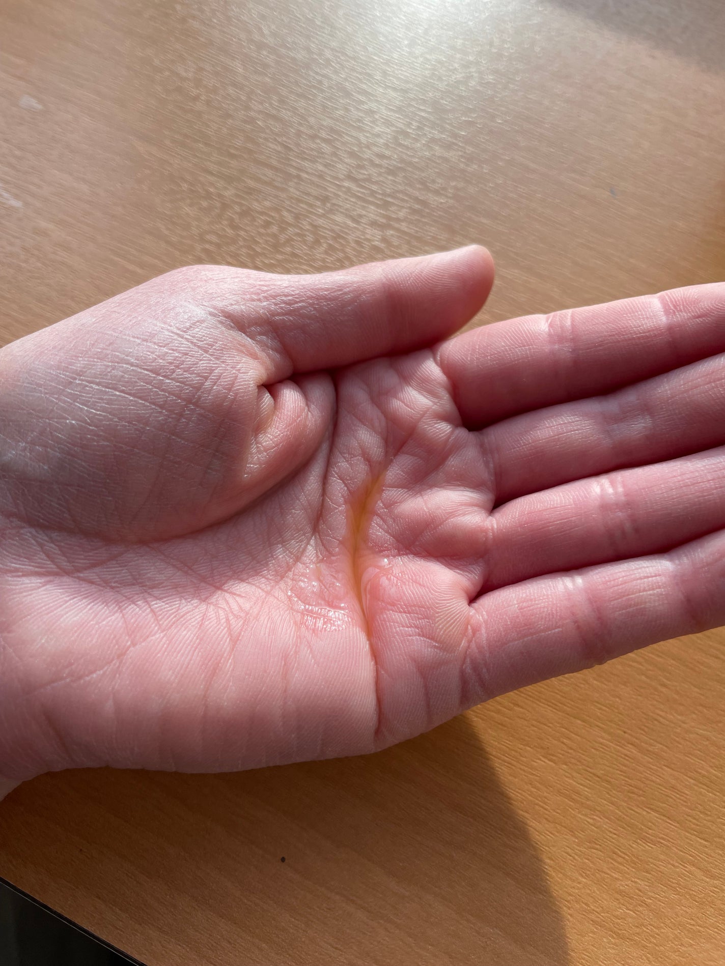 ガラクトミセスピュアビタミンCグロートナー/SOME BY MI/化粧水を使ったクチコミ(4枚目)