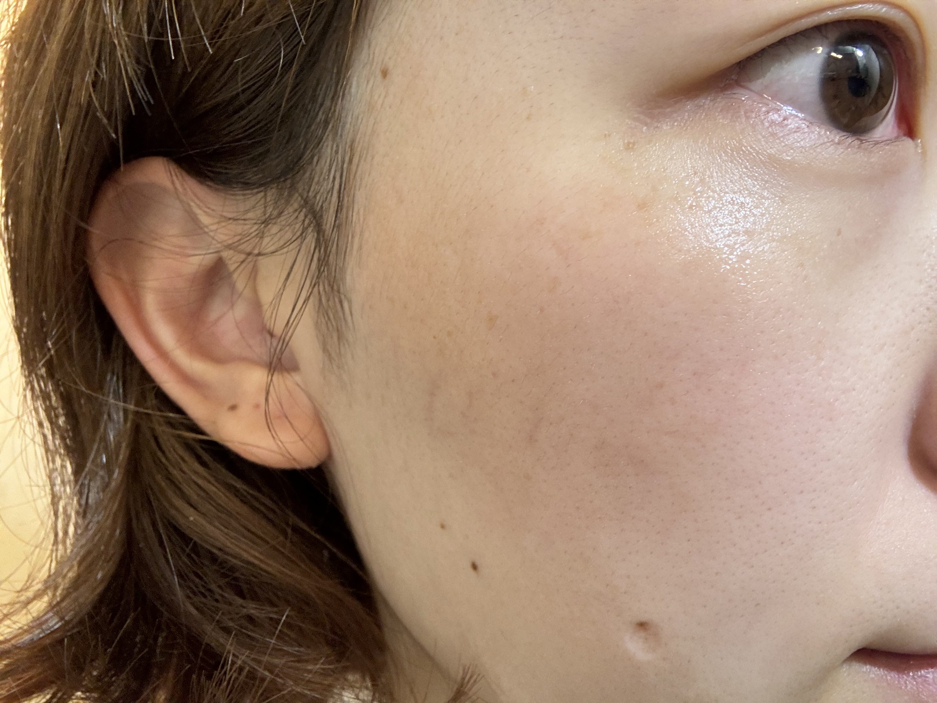 PDRNビタトーニングアンプル/Genabelle/美容液を使ったクチコミ（3枚目）