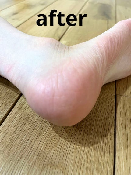 イージーパックDP60分タイプ/ベビーフット/レッグ・フットケアを使ったクチコミ(6枚目)