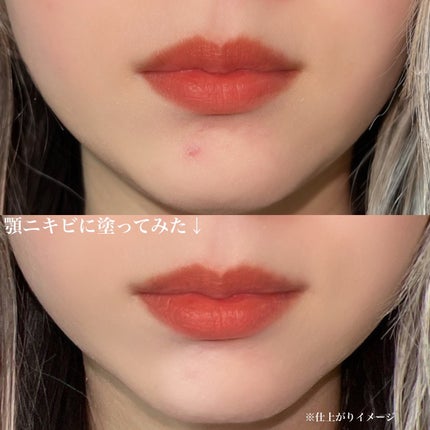 イプノス シーバムクリア リペアクリーム/ACSEINE/フェイスクリームを使ったクチコミ(5枚目)