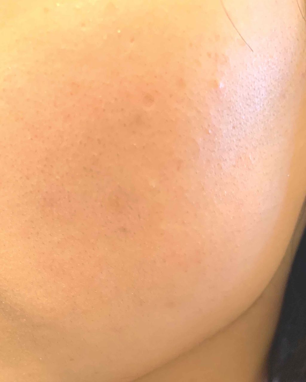 聖愛 on LIPS 「せなです✊🏻🌟お久しぶりの投稿となります!今回は私の肌事情につ..」(3枚目)