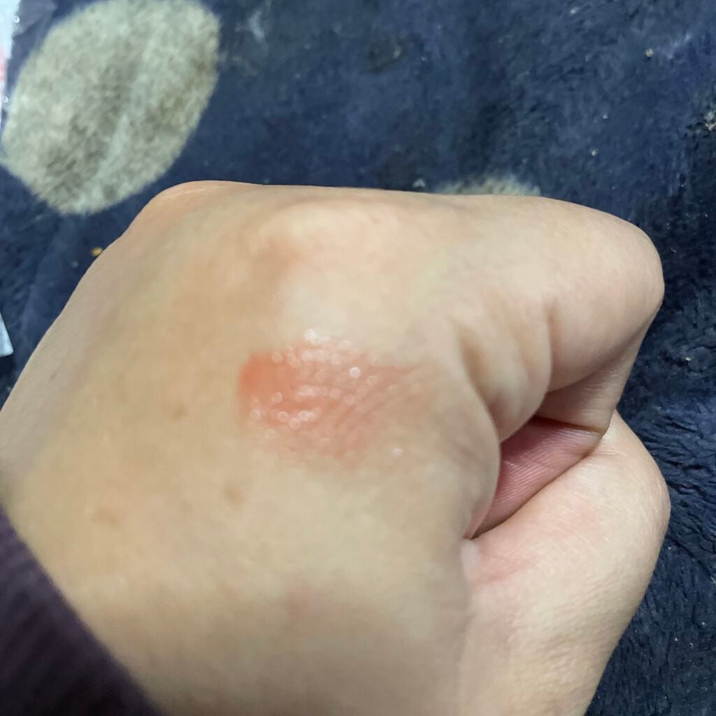 レブロン キス グロウ バーム N/REVLON/口紅を使ったクチコミ(2枚目)