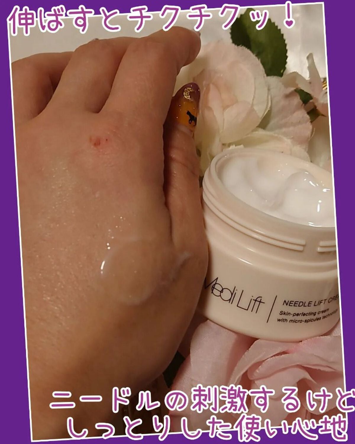 メディリフト ニードルリフトクリーム/YA-MAN TOKYO JAPAN/フェイスクリームを使ったクチコミ(4枚目)
