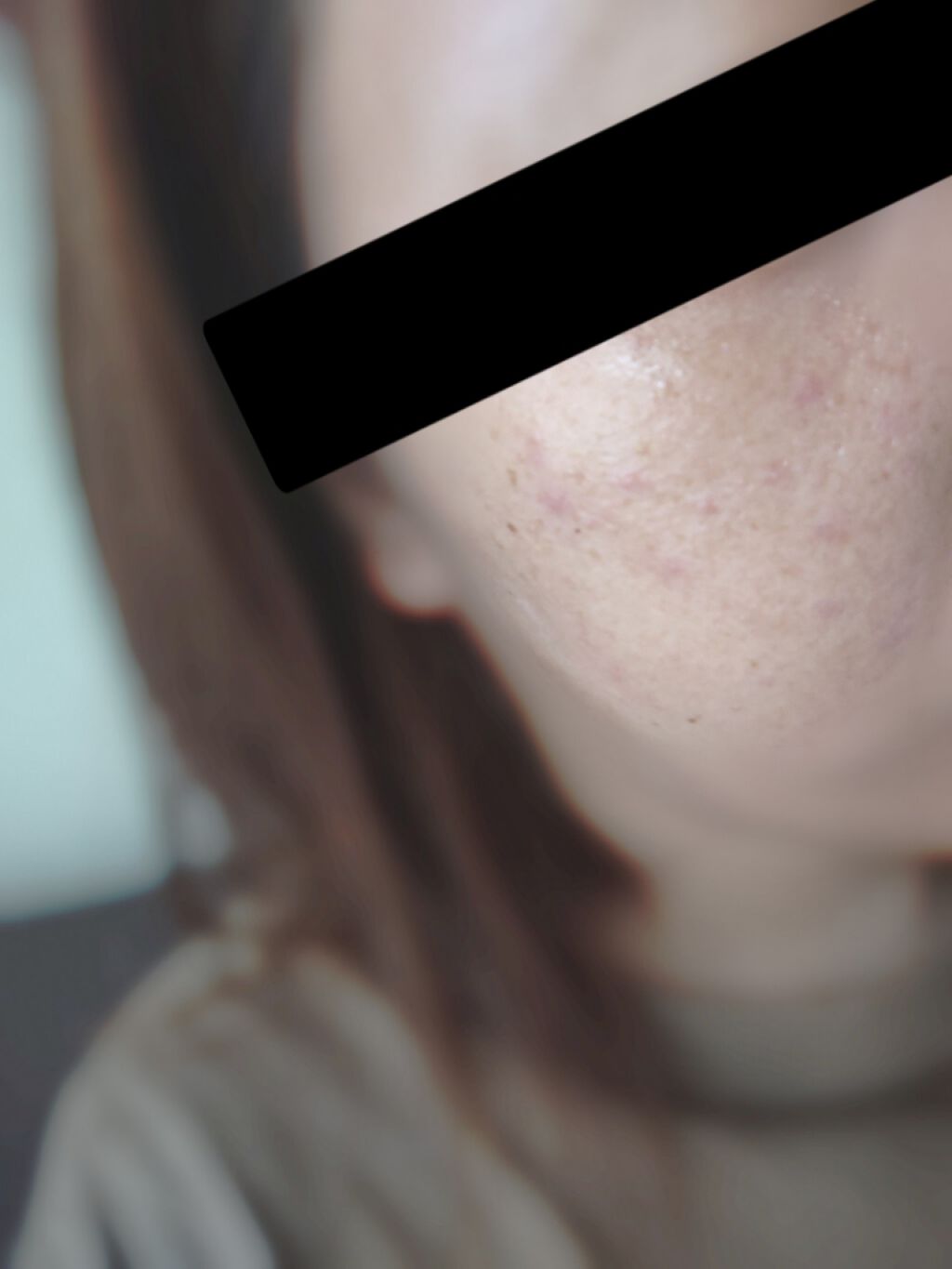 MILK BUBBLE ESSENCE PACK ＃PLAIN/G9SKIN/美容液を使ったクチコミ（3枚目）