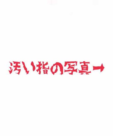 ヘパリン類似物質 油性クリーム0.3%「日医工」/日医工ファーマ/その他スキンケアを使ったクチコミ（1枚目）